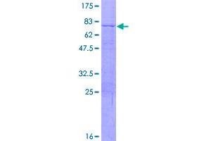 Image no. 1 for Collagen, Type VIII, alpha 2 (COL8A2) protein (GST tag) (ABIN1349986)
