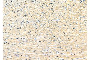 ABIN6265899 and ABIN6273182 at 1/100 staining Rat heart tissue by IHC-P. (UQCRC1 anticorps  (C-Term))