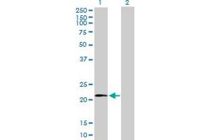Western Blot analysis of MRPL11 expression in transfected 293T cell line by MRPL11 MaxPab polyclonal antibody. (MRPL11 anticorps  (AA 1-192))