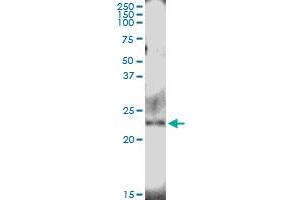 Immunoprecipitation of NUDT4 transfected lysate using anti-NUDT4 MaxPab rabbit polyclonal antibody and Protein A Magnetic Bead , and immunoblotted with NUDT4 purified MaxPab mouse polyclonal antibody (B01P) .