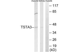 Western blot analysis of extracts from rat kidney cells and rat muscle cells, using TSTA3 antibody. (TSTA3 anticorps  (C-Term))