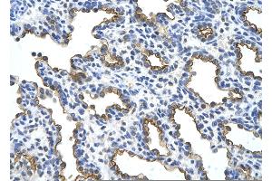 Rabbit Anti-MUC1 Antibody       Paraffin Embedded Tissue:  Human alveolar cell   Cellular Data:  Epithelial cells of renal tubule  Antibody Concentration:   4. (MUC1 anticorps  (C-Term))
