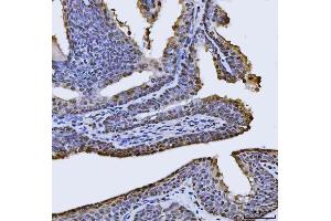IHC analysis of FIP1L1 using anti-FIP1L1 antibody (ABIN7600761). (FIP1L1 anticorps  (AA 23-558))