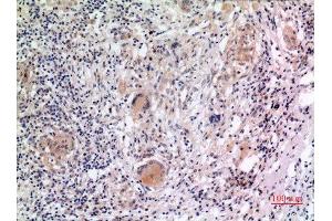Immunohistochemistry (IHC) analysis of paraffin-embedded Human Lung, antibody was diluted at 1:100.