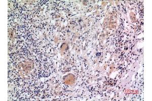 Immunohistochemistry (IHC) analysis of paraffin-embedded Human Lung, antibody was diluted at 1:100. (NLRP3 anticorps  (Internal Region))