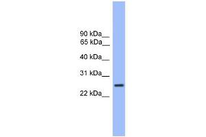 WB Suggested Anti-GOSR1 Antibody Titration: 0. (GS28 anticorps  (C-Term))