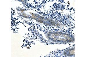 IHC analysis of PPM1A using anti-PPM1A antibody (ABIN7603116).