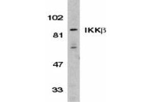 Western blot analysis of IKK beta in Jurkat whole cell lysate with AP30406PU-N IKK beta antibody (C3) at 1/500 dilution. (IKBKB anticorps  (C-Term))