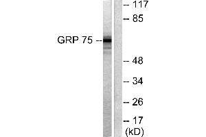 Western blot analysis of extracts from COS7 cells, using GRP75 antibody (#C0216). (HSPA9 anticorps)