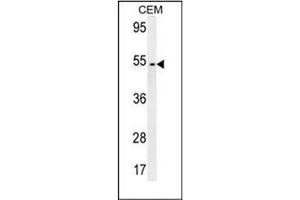 Western blot analysis of FAM46A Antibody (Center) in CEM cell line lysates (35ug/lane). (FAM46A anticorps  (Middle Region))