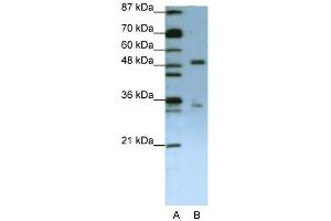 WB Suggested Anti-UPF3B Antibody Titration:  1. (UPF3B anticorps  (N-Term))