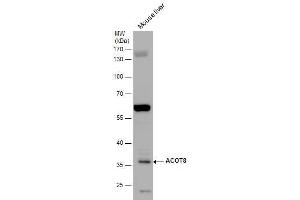 WB Image ACOT8 antibody detects ACOT8 protein by western blot analysis. (ACOT8 anticorps)