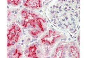 Human Kidney: Formalin-Fixed, Paraffin-Embedded (FFPE).