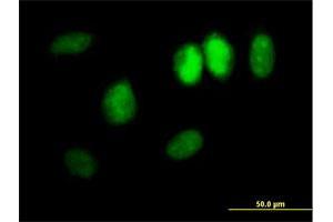 Immunofluorescence of purified MaxPab antibody to DDX11 on HeLa cell. (DDX11 anticorps  (AA 1-970))