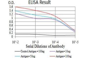 Black line: Control Antigen (100 ng);Purple line: Antigen (10ng); Blue line: Antigen (50 ng); Red line:Antigen (100 ng)