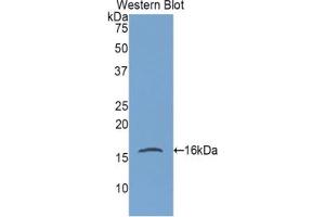 Western blot analysis of the recombinant protein. (Gastrokine 1 anticorps  (AA 27-151))