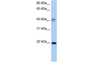 WB Suggested Anti-DLX4 Antibody Titration:  0. (DLX4 anticorps  (Middle Region))