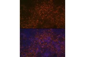 Immunofluorescence analysis of rat spleen using CD38 Rabbit pAb (ABIN6130076, ABIN6138177, ABIN6138178 and ABIN6217677) at dilution of 1:100 (40x lens). (CD38 anticorps  (AA 46-300))