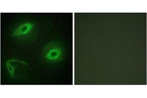 Immunofluorescence analysis of HeLa cells, using LATH antibody. (LATH anticorps  (Internal Region))