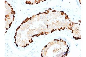Formalin-fixed, paraffin-embedded human Testis stained with MAGEA4 Mouse Monoclonal Antibody (CPTC-MAGEA4-1). (MAGEA4 anticorps)