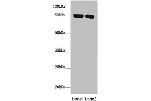 Western blot All lanes: NDUFS1 antibody at 2.