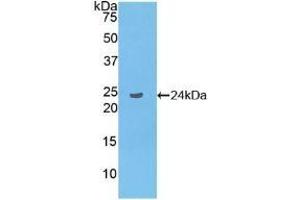 Detection of Recombinant LAT2, Human using Polyclonal Antibody to Linker For Activation Of T-Cells Family, Member 2 (LAT2) (LAT2 anticorps  (AA 30-209))