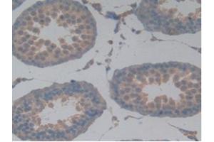 Detection of MAPT in Rat Testis Tissue using Polyclonal Antibody to Tau Protein (MAPT) (tau anticorps  (AA 34-368))