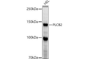Western blot analysis of extracts of HEL cells, using PLCB2 antibody (ABIN6133052, ABIN6145747, ABIN6145748 and ABIN6224164) at 1:1000 dilution. (Phospholipase C beta 2 anticorps  (AA 1-199))