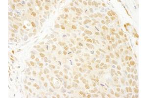 Immunohistochemistry (IHC) image for anti-Ankyrin Repeat Domain 17 (ANKRD17) (AA 1550-1600) antibody (ABIN7448409)