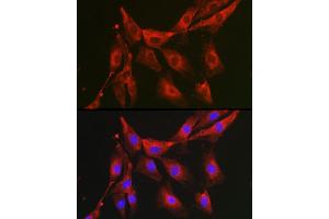 Immunofluorescence analysis of NIH-3T3 cells using FBP1 Rabbit pAb (ABIN6130385, ABIN6140501, ABIN6140502 and ABIN6221054) at dilution of 1:100 (40x lens). (FBP1 anticorps  (AA 1-338))