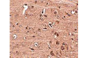 Immunohistochemistry of GLE1 in mouse brain tissue with GLE1 polyclonal antibody  at 2. (GLE1 anticorps  (C-Term))