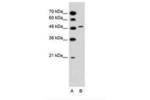 Image no. 2 for anti-Solute Carrier Family 10 (Sodium/bile Acid Cotransporter Family), Member 5 (SLC10A5) (AA 351-400) antibody (ABIN205007) (SLC10A5 anticorps  (AA 351-400))
