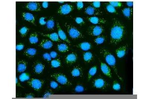 IF analysis of Dysferlin/DYSF using anti-Dysferlin/DYSF antibody (ABIN7601939).