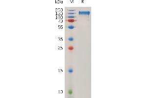 Human ITGAV & I Heterodimer Protein, His Tag & hFc Tag on SDS-PAGE under reducing condition.