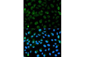 Immunofluorescence analysis of HeLa cell using PML antibody. (PML anticorps)