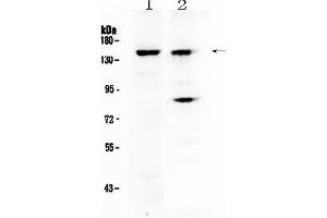 Western blot analysis of FBXL11 using anti-FBXL11 antibody . (KDM2A anticorps)
