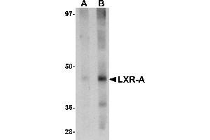 Western Blotting (WB) image for anti-Nuclear Receptor Subfamily 1, Group H, Member 3 (NR1H3) (N-Term) antibody (ABIN1031443)
