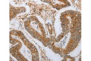 Immunohistochemistry (IHC) image for anti-Neurogenin 1 (NEUROG1) antibody (ABIN3017394) (Neurogenin 1 anticorps)
