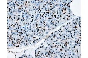 Immunohistochemical staining of paraffin-embedded colon tissue using anti-RPA2mouse monoclonal antibody. (RPA2 anticorps)