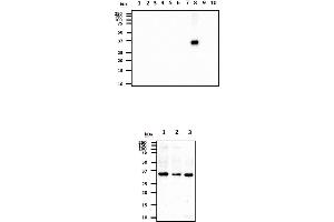 The recombinant proteins (20ng) were resolved by SDS-PAGE, transferred to PVDF membrane and probed with anti-human CTSS antibody (1:1000).