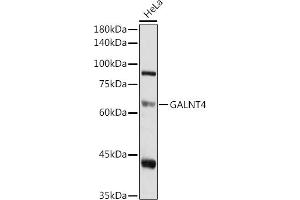 Western blot analysis of extracts of HeLa cells, using G antibody (ABIN6135078, ABIN6140946, ABIN7101653 and ABIN7101654) at 1:1000 dilution. (GALNT4 anticorps)