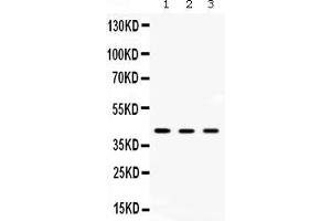 Western blot analysis of AMACR expression in rat kidney extract ( Lane 1), rat liver extract ( Lane 2) and HEPG2 whole cell lysates ( Lane 3).