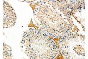 anti-Dynein, Cytoplasmic 2, Light Intermediate Chain 1 (DYNC2LI1) (Internal Region) antibody