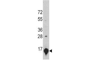 A375 cell lysates probed with GLT (24CT661.