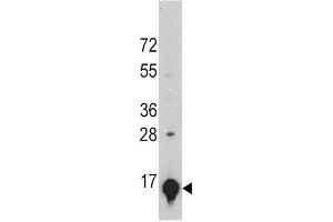 A375 cell lysates probed with GLT (24CT661. (SLC1A2 anticorps)
