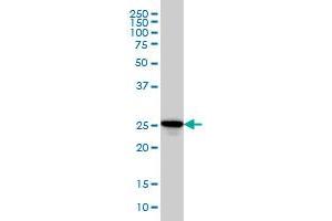 RAB27A monoclonal antibody (M02), clone 1G7 Western Blot analysis of RAB27A expression in HL-60 .