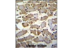 ZMYND17 Antibody (C-term) (ABIN655547 and ABIN2845056) immunohistochemistry analysis in formalin fixed and paraffin embedded human skeletal muscle followed by peroxidase conjugation of the secondary antibody and DAB staining. (ZMYND17 anticorps  (C-Term))