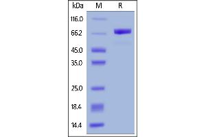 RFP Fusion Human Mesothelin (296-580), His Tag on  under reducing (R) condition.