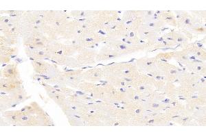 Detection of LAMP3 in Human Cardiac Muscle Tissue using Polyclonal Antibody to Lysosomal Associated Membrane Protein 3 (LAMP3)