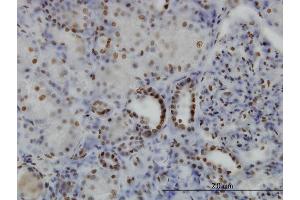 Immunoperoxidase of monoclonal antibody to SGK on formalin-fixed paraffin-embedded human kidney. (SGK1 anticorps  (AA 1-90))